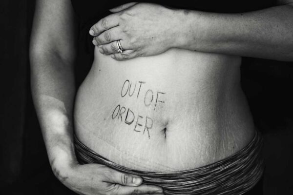 Woman holding her shirt up to show her belly with the words "out of order" written over her stretchmarks